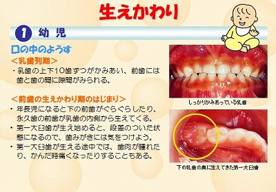 乳歯 生え 変わり