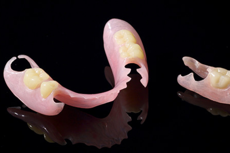 バネの見えない自然な入れ歯